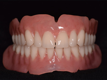 Denture Services