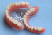 Denture Options