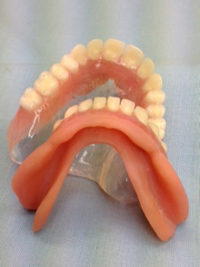 Denture Reline