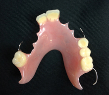 Partial Dentures