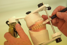 Denture Options